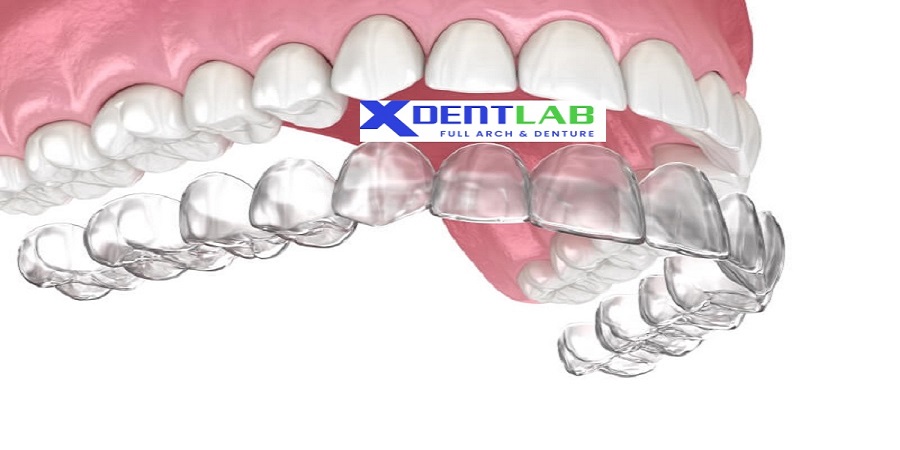 Clear aligner fabrication services