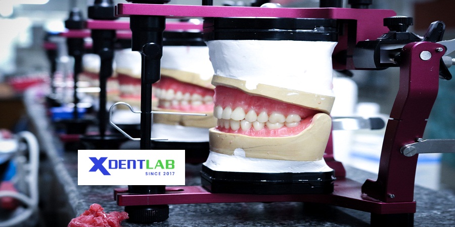 Dental Labs in vietnam District 7 Ho Chi Minh