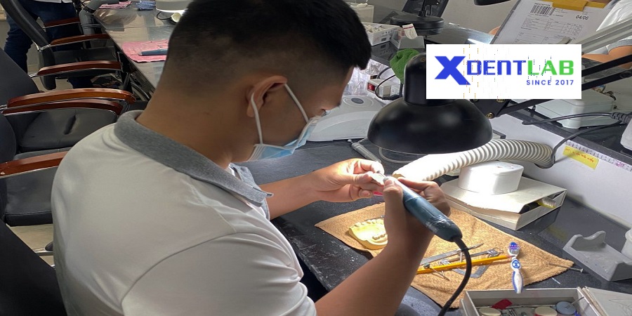 Vietnam dental laboratories district 7 Ho Chi Minh